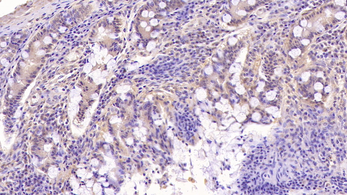 Monoclonal Antibody to Transferrin Receptor (TFR)