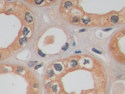 Monoclonal Antibody to Glucose Transporter 1 (GLUT1)