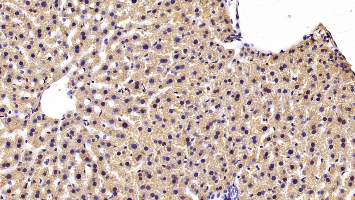 Monoclonal Antibody to Aspartate Aminotransferase (AST)