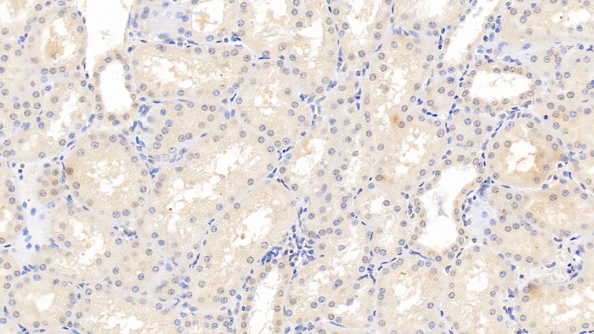 Monoclonal Antibody to Fibrinogen Beta Chain (FGB)