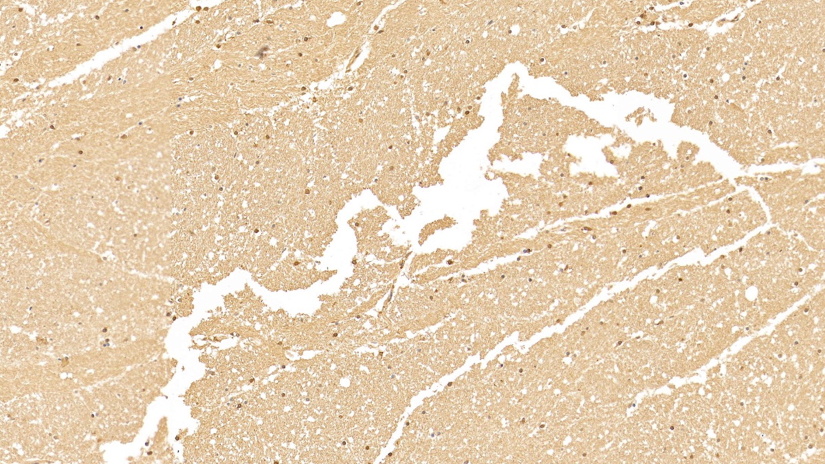 Monoclonal Antibody to Cytokeratin 18 (CK18)