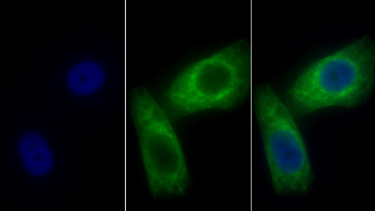 Monoclonal Antibody to Cytokeratin 18 (CK18)