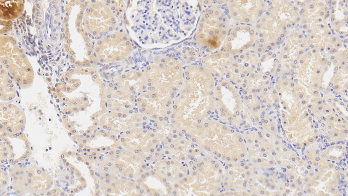 Monoclonal Antibody to Plasminogen (Plg)