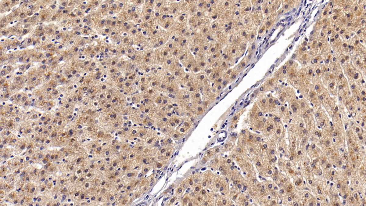 Monoclonal Antibody to Angiostatin (ANG)