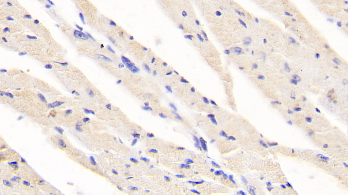 Monoclonal Antibody to Ret Proto-Oncogene (RET)