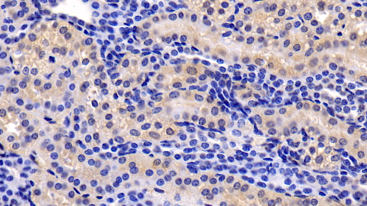 Monoclonal Antibody to Thymic Stromal Lymphopoietin (TSLP)