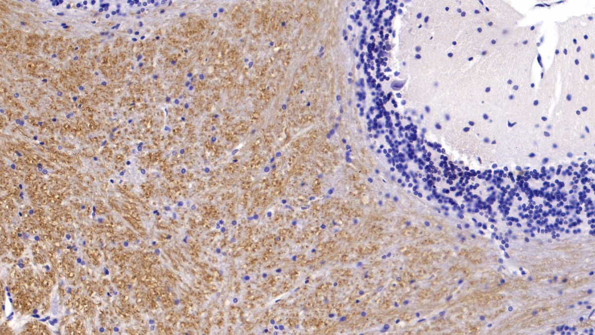 Monoclonal Antibody to Microtubule Associated Protein 2 (MAP2)