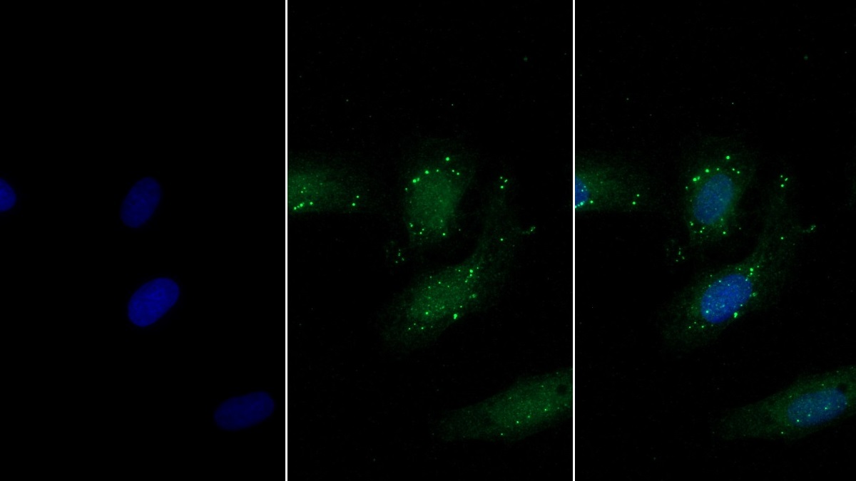 Monoclonal Antibody to Beta-1,3-Glucuronyltransferase 1 (b3GAT1)