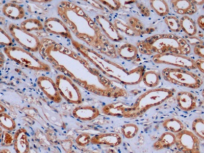 Monoclonal Antibody to Beta Actin (ACTB)