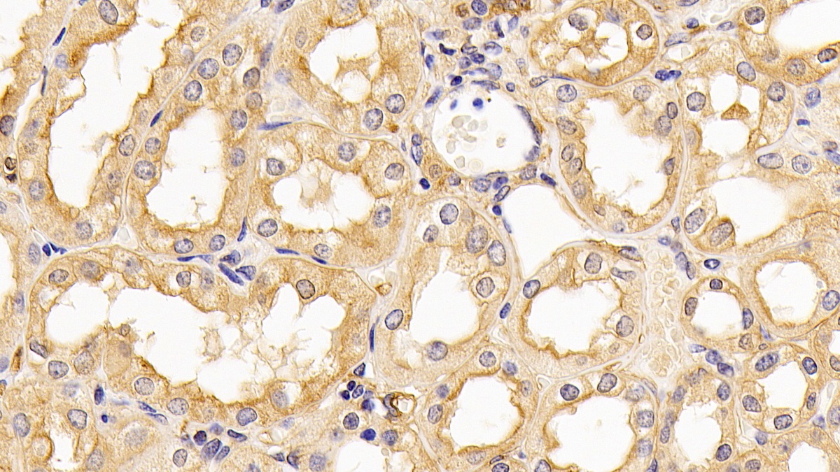 Monoclonal Antibody to Beta Actin (ACTB)