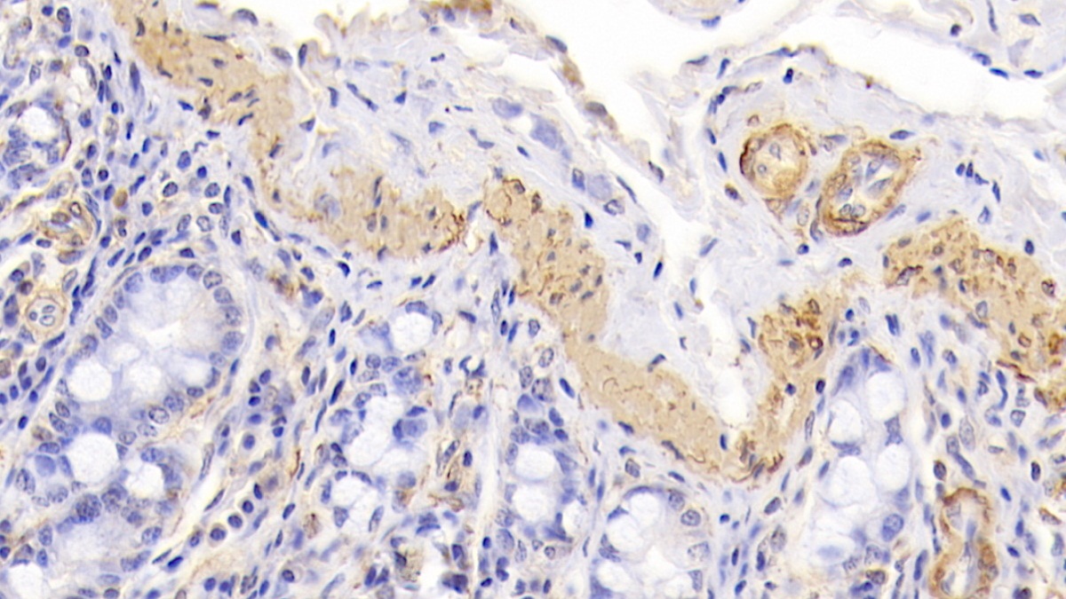 Monoclonal Antibody to Actin Alpha 1, Cardiac Muscle (ACTC1)