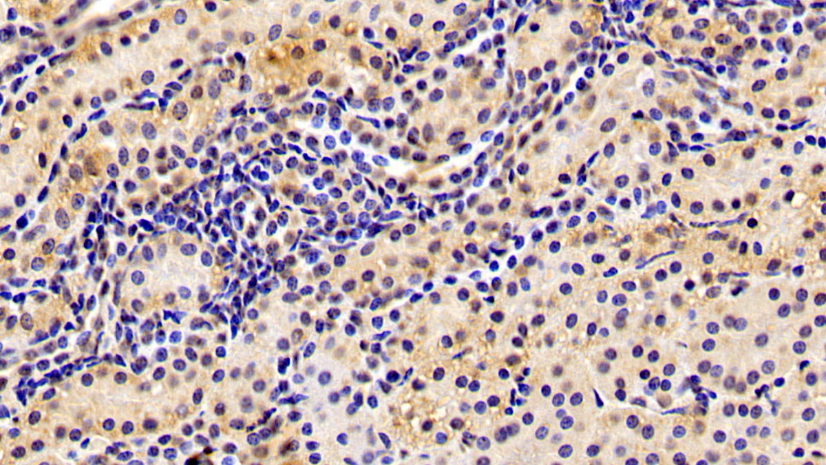 Monoclonal Antibody to Aryl Hydrocarbon Receptor (AhR)