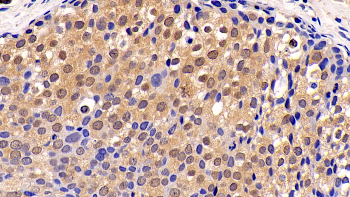 Monoclonal Antibody to Extracellular Signal Regulated Kinase 1 (ERK1)