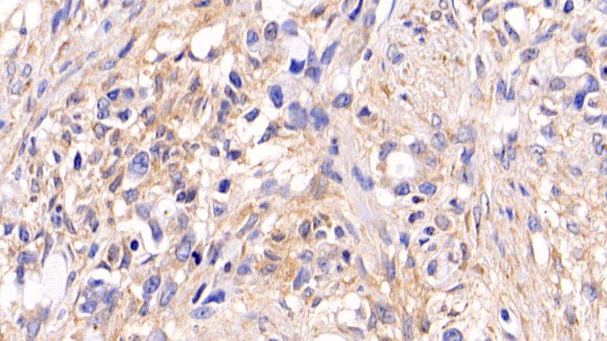 Monoclonal Antibody to Extracellular Signal Regulated Kinase 1 (ERK1)