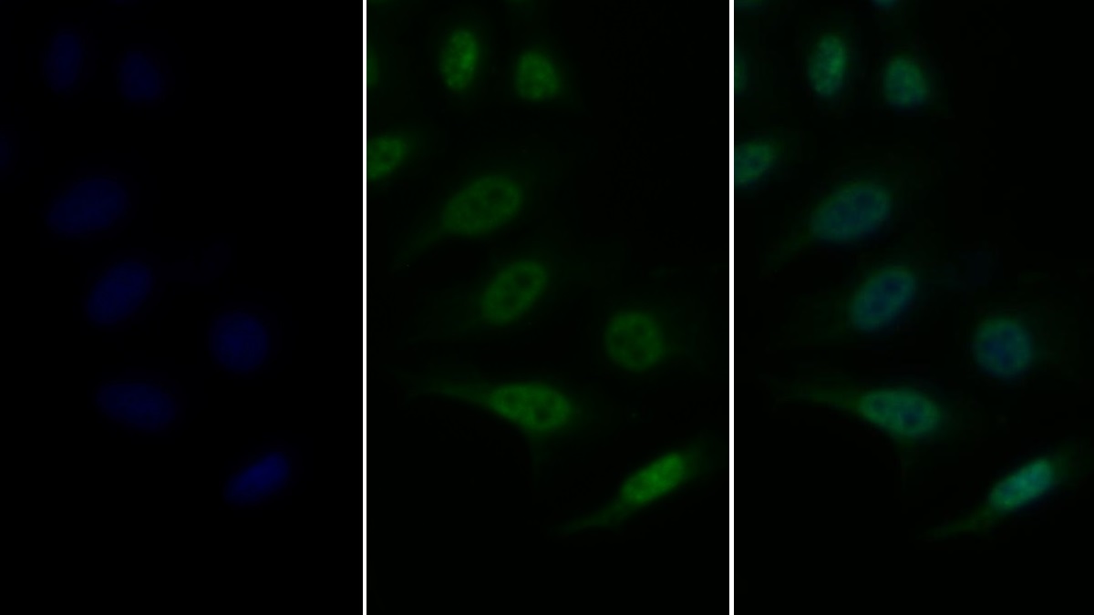Monoclonal Antibody to Vascular Endothelial Growth Factor Receptor 2 (VEGFR2)
