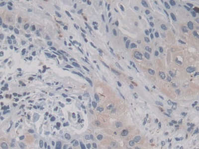 Monoclonal Antibody to Neutrophil gelatinase-associated lipocalin (NGAL)