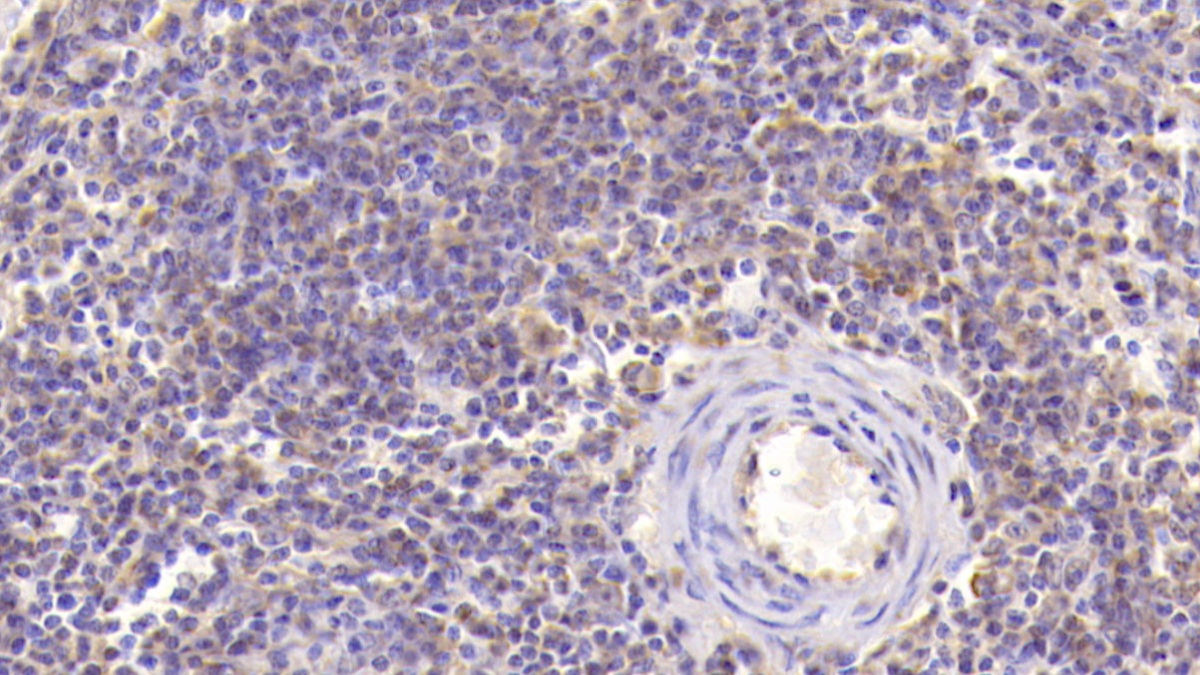 Monoclonal Antibody to Cluster of Differentiation 90 (CD90)