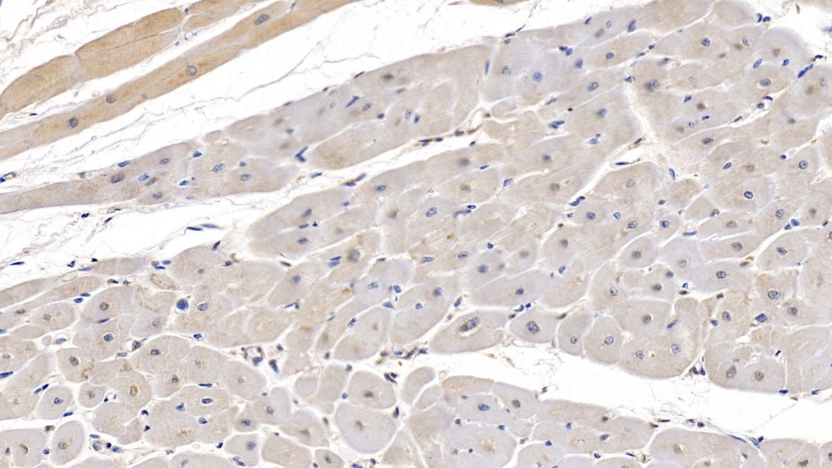 Monoclonal Antibody to Complement Component 1, Q Receptor (C1qR1)