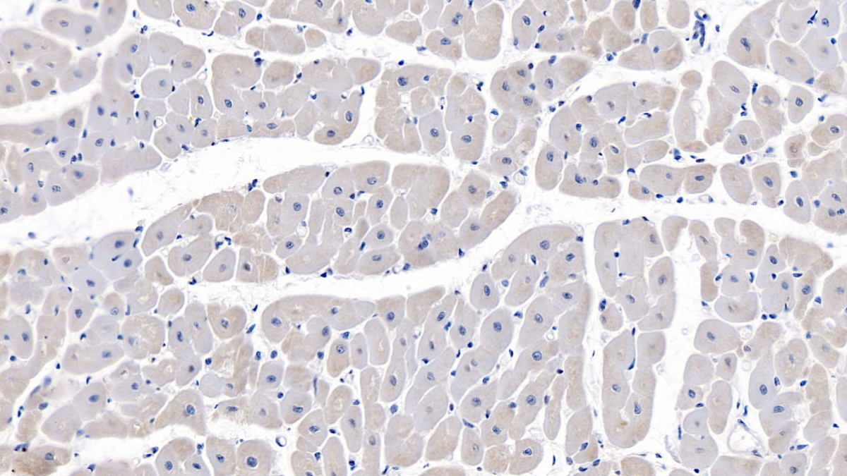 Monoclonal Antibody to Complement Component 1, Q Receptor (C1qR1)