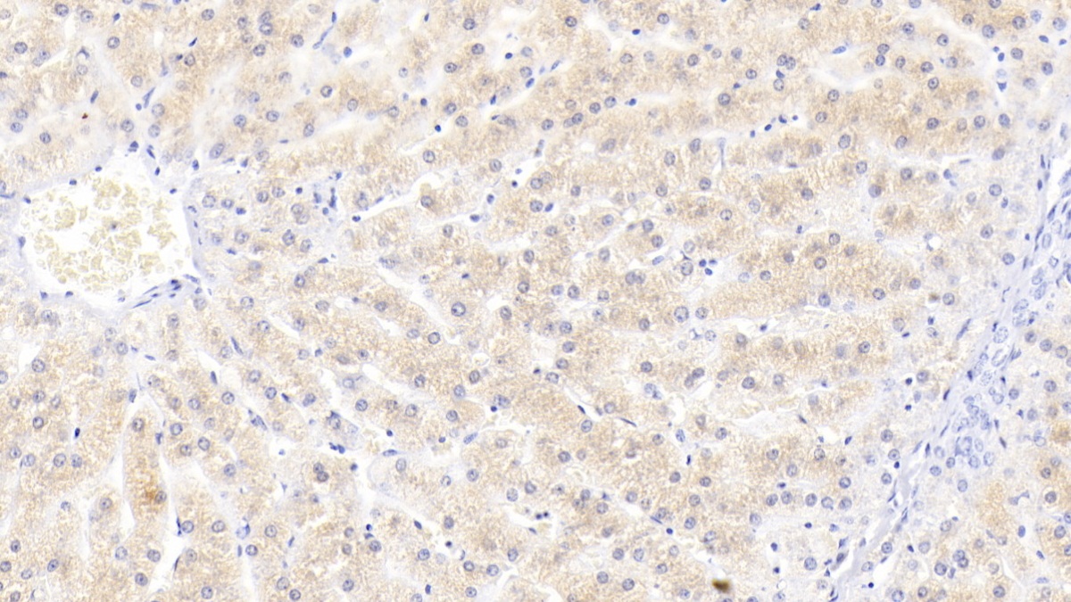 Monoclonal Antibody to Lipopolysaccharide Binding Protein (LBP)