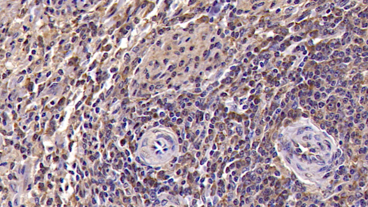 Monoclonal Antibody to Killer Cell Lectin Like Receptor Subfamily D, Member 1 (KLRD1)