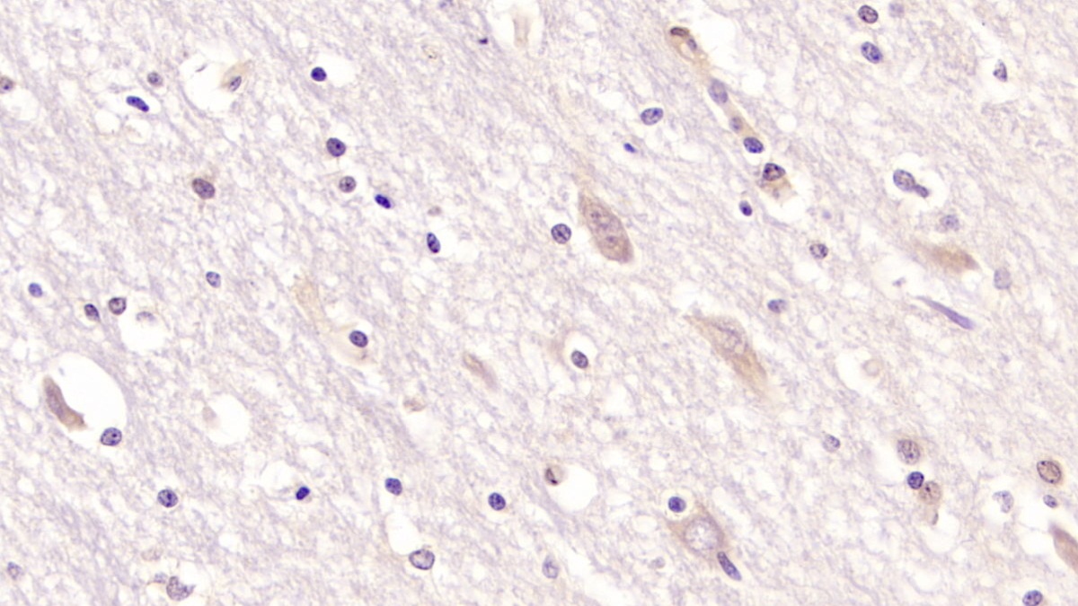 Monoclonal Antibody to Cluster Of Differentiation 97 (CD97)