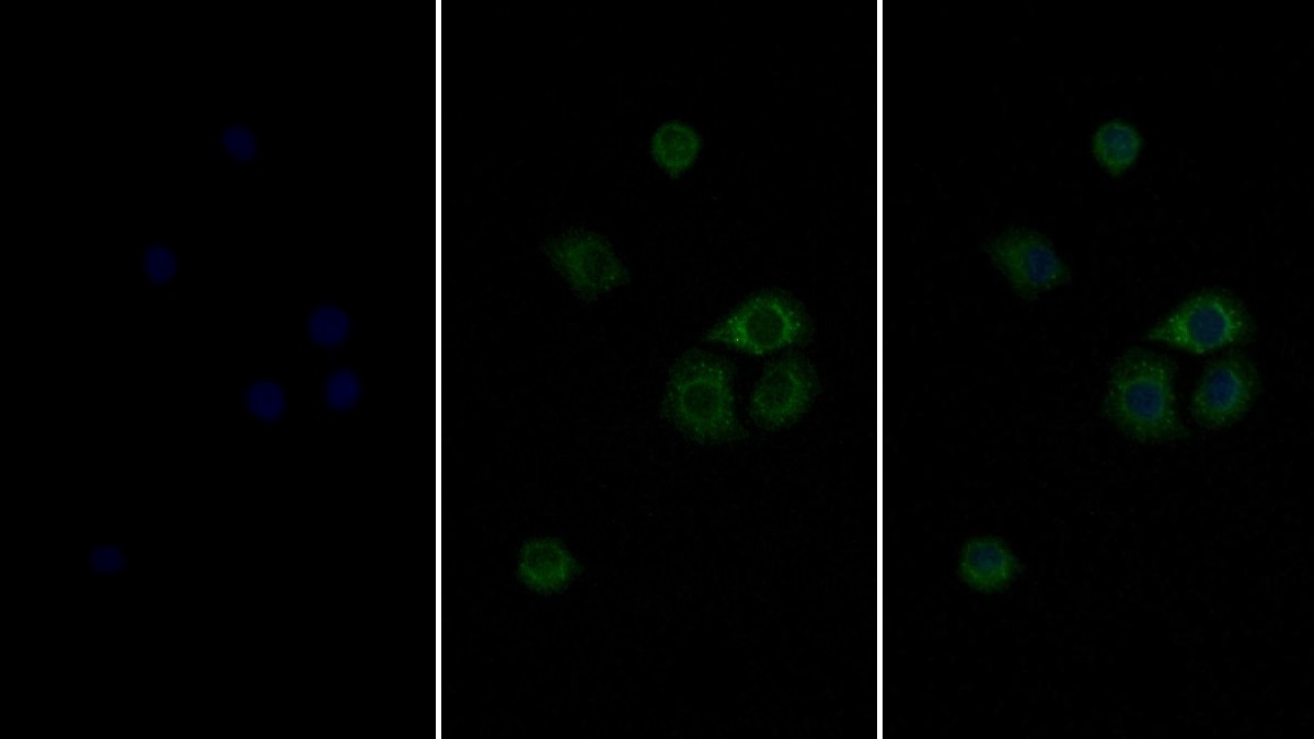 Monoclonal Antibody to Interferon Alpha/Beta Receptor 1 (IFNa/bR1)