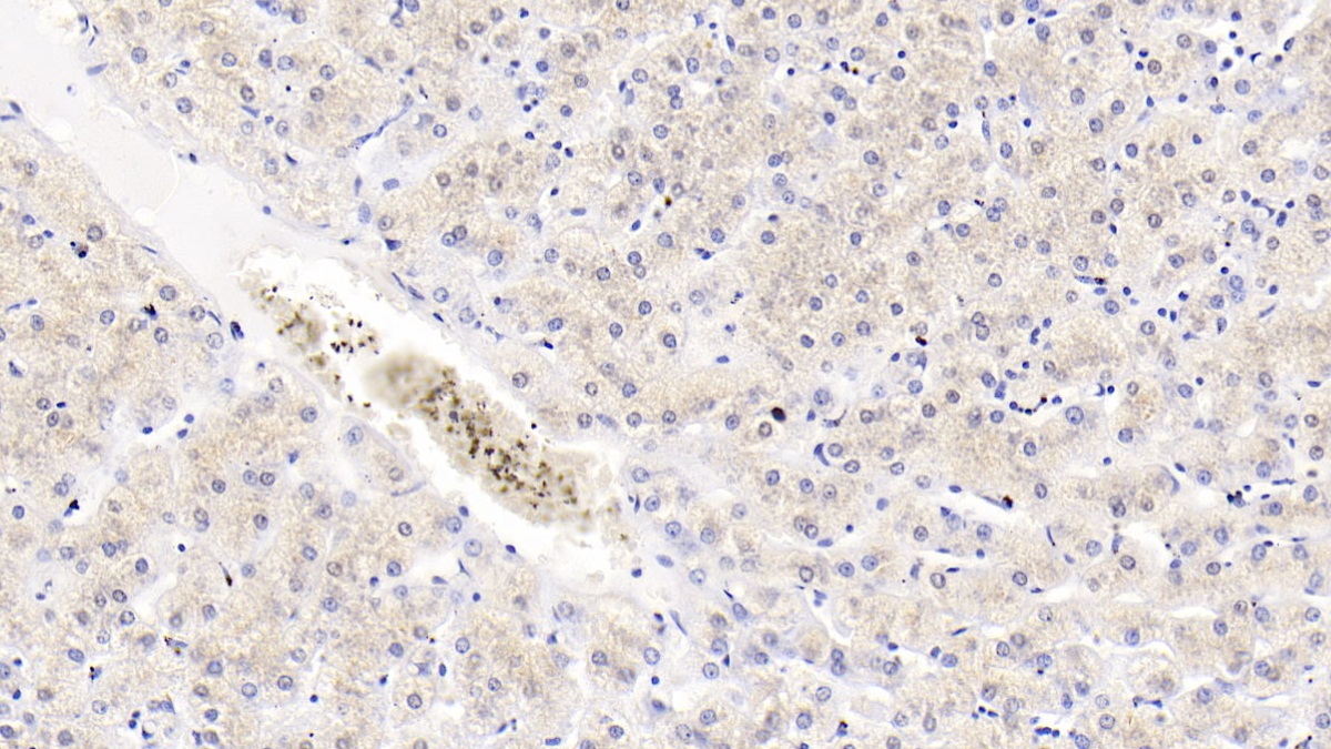 Monoclonal Antibody to Acetylcholinesterase (ACHE)