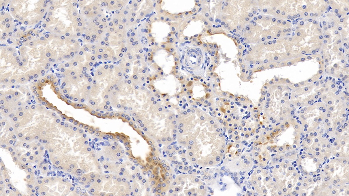 Monoclonal Antibody to Nectin 2 (NECTIN2)