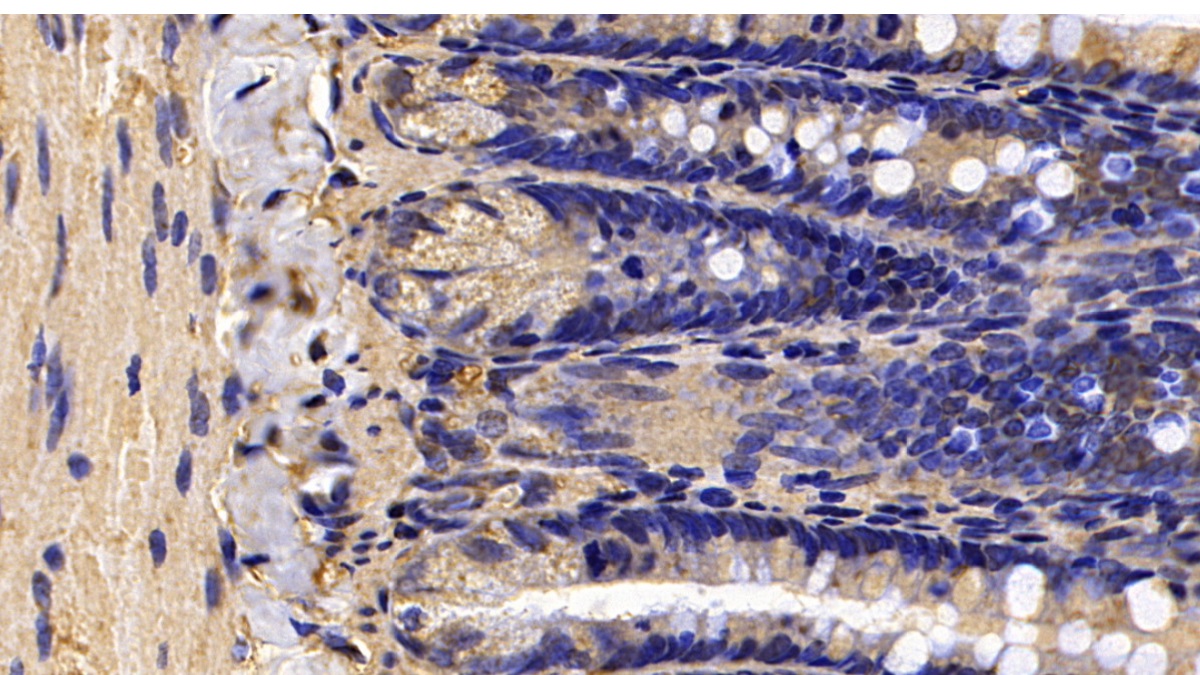 Monoclonal Antibody to Calreticulin (CALR)