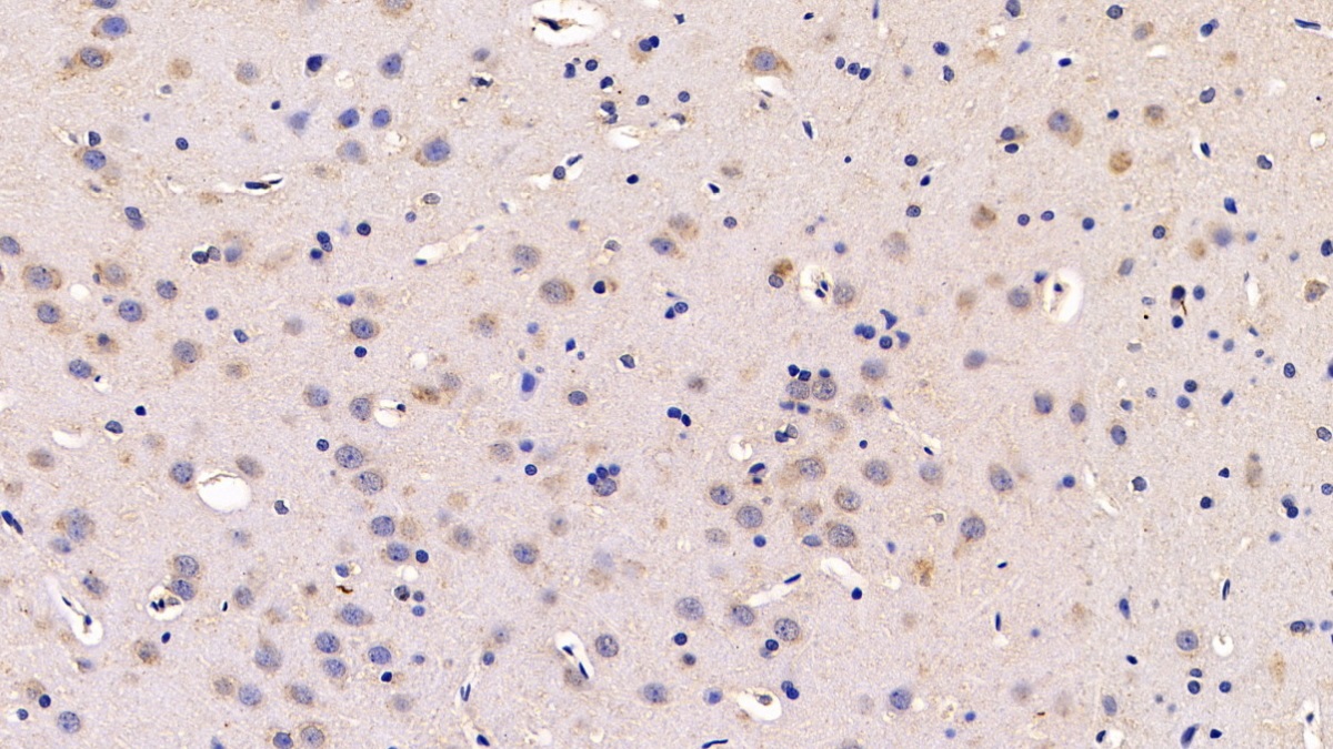 Monoclonal Antibody to Calreticulin (CALR)