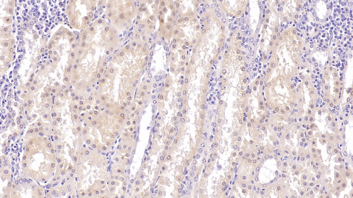 Monoclonal Antibody to Lumican (LUM)