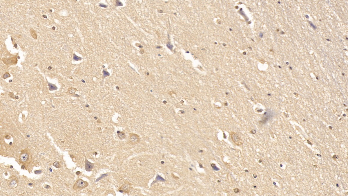 Monoclonal Antibody to Dystrophin (DMD)