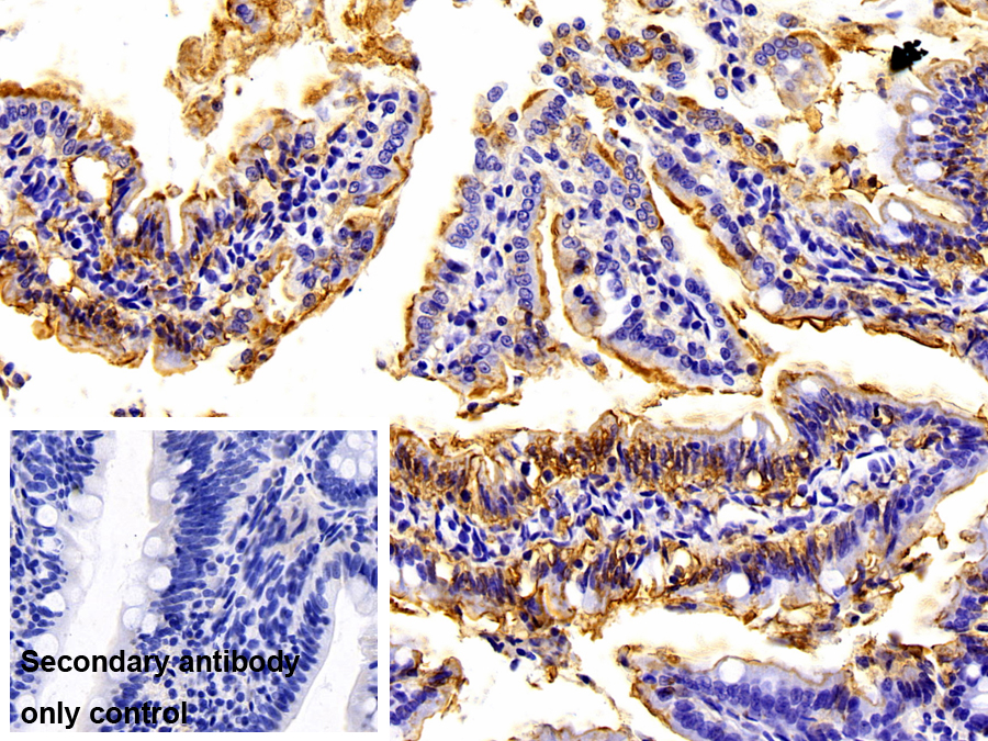 Monoclonal Antibody to Lipopolysaccharide (LPS)