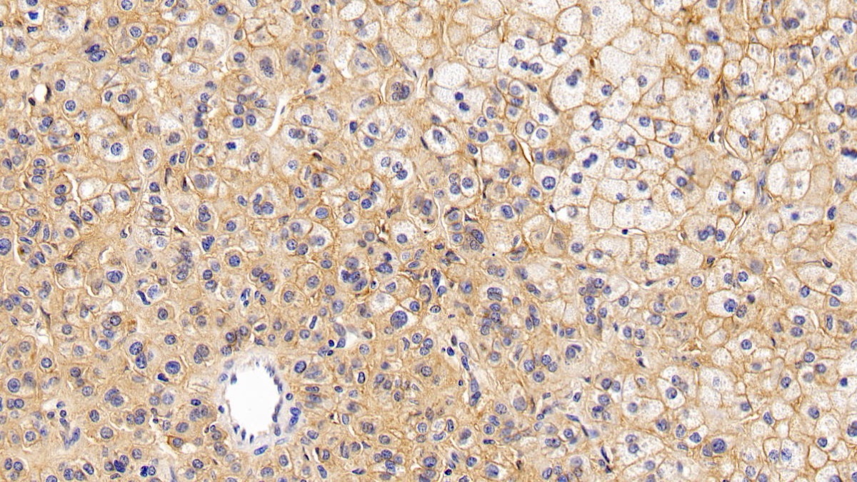 Monoclonal Antibody to Cluster Of Differentiation 147 (CD147)