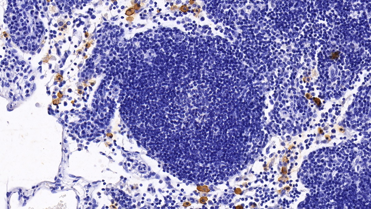 Monoclonal Antibody to Bone Marrow Stromal Cell Antigen 1 (BST1)