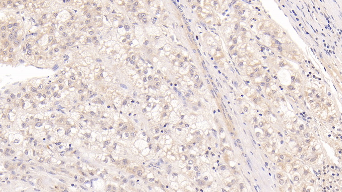 Monoclonal Antibody to Major Basic Protein (MBP)