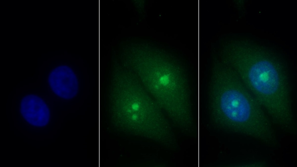 Monoclonal Antibody to Trefoil Factor 3 (TFF3)