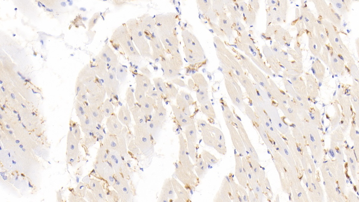 Monoclonal Antibody to Fatty Acid Binding Protein 4 (FABP4)