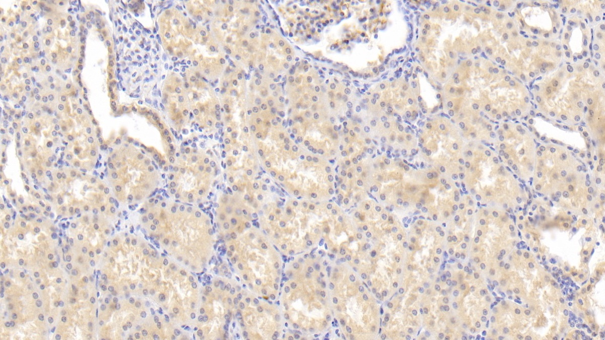 Monoclonal Antibody to Fatty Acid Binding Protein 4 (FABP4)