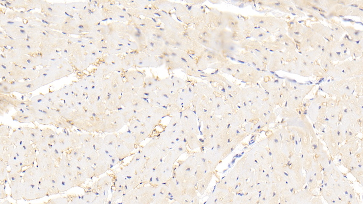 Monoclonal Antibody to Fatty Acid Binding Protein 4 (FABP4)