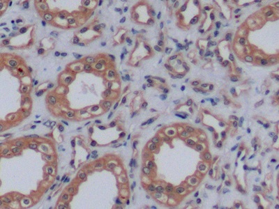 Monoclonal Antibody to Vascular Endothelial Growth Factor 165 (VEGF165)