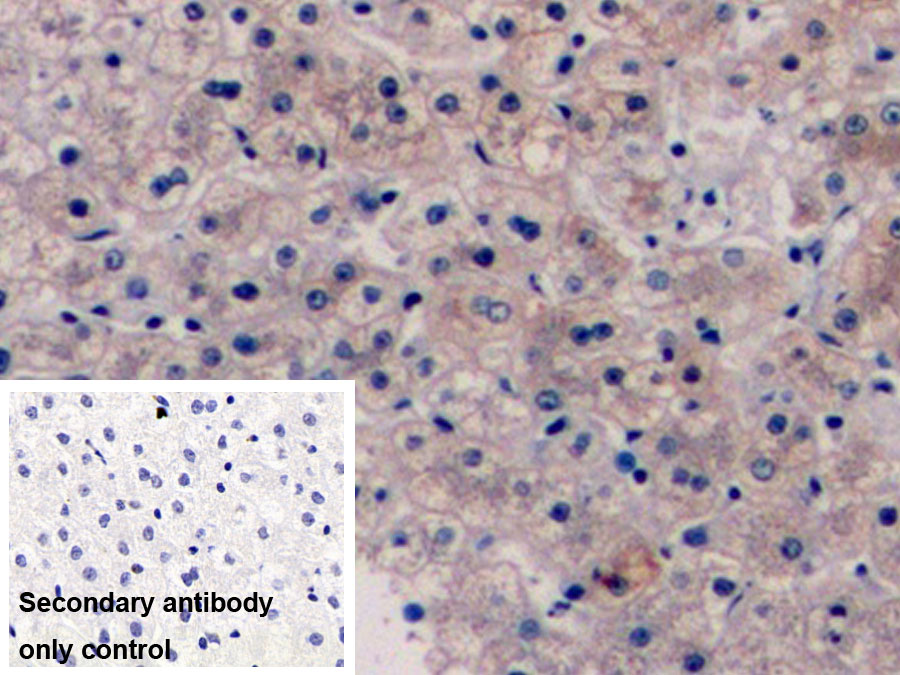 Monoclonal Antibody to Vascular Endothelial Growth Factor 165 (VEGF165)