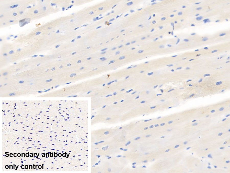 Monoclonal Antibody to Vascular Endothelial Growth Factor 165 (VEGF165)