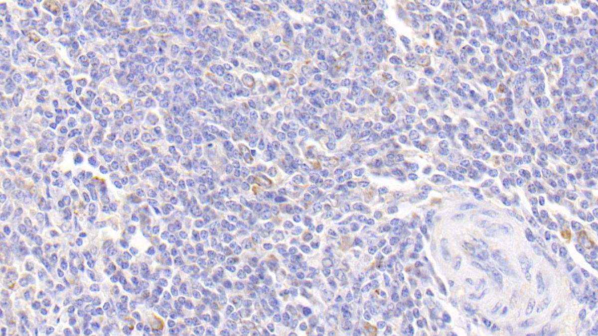 Monoclonal Antibody to Alpha-1-Antitrypsin (a1AT)