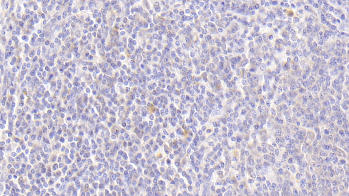 Monoclonal Antibody to Alpha-1-Antitrypsin (a1AT)