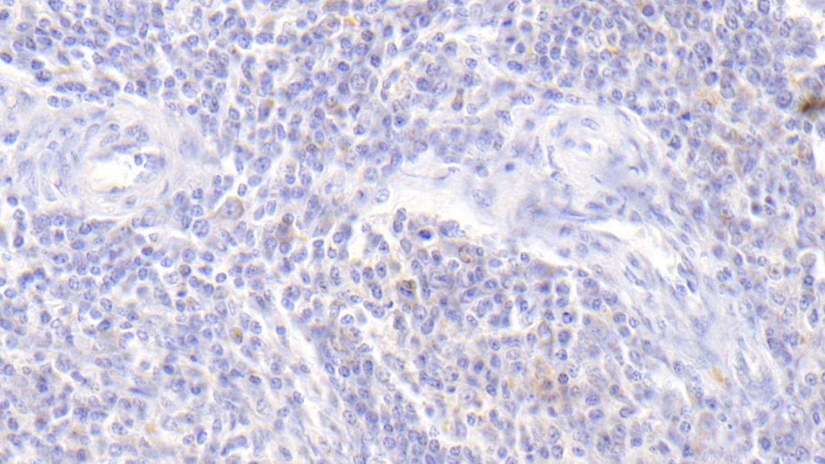 Monoclonal Antibody to Alpha-1-Antitrypsin (a1AT)