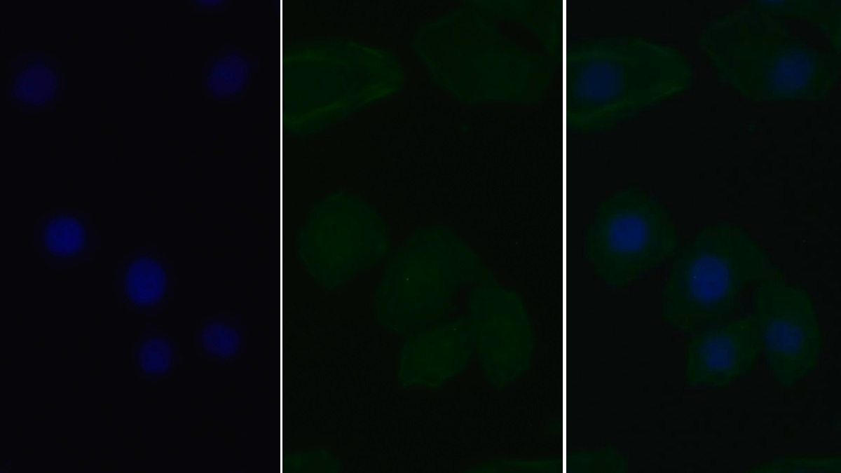 Monoclonal Antibody to Signal Transducer And Activator Of Transcription 3 (STAT3)