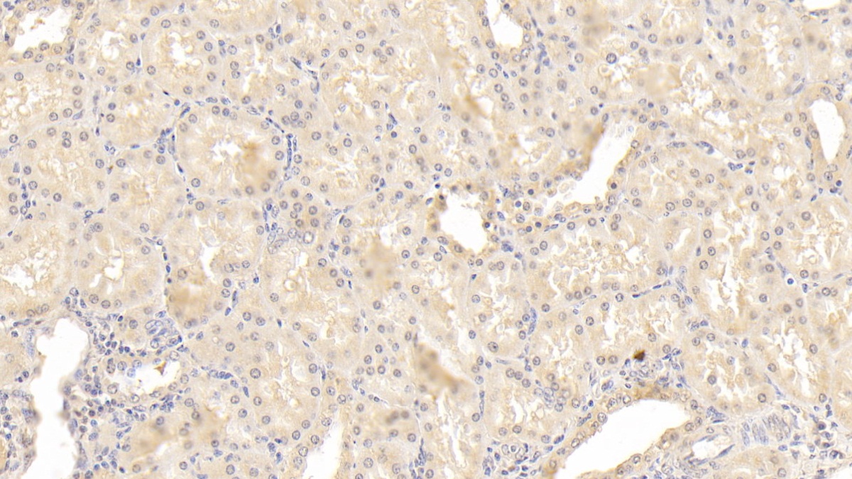 Monoclonal Antibody to Inhibin Beta B (INHbB)