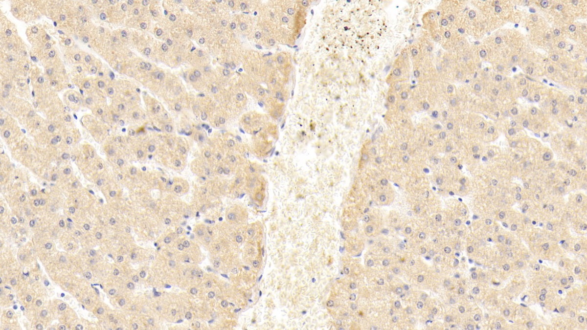 Monoclonal Antibody to Inhibin Beta B (INHbB)